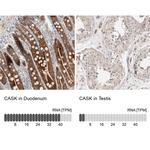 CASK Antibody in Immunohistochemistry (IHC)