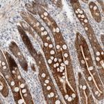 CASK Antibody in Immunohistochemistry (IHC)