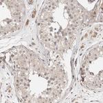 CASK Antibody in Immunohistochemistry (IHC)