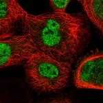 CDR2 Polyclonal Antibody