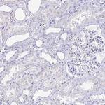 PAGE4 Antibody in Immunohistochemistry (Paraffin) (IHC (P))