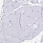 PAGE4 Antibody in Immunohistochemistry (Paraffin) (IHC (P))