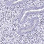 PAGE4 Antibody in Immunohistochemistry (IHC)