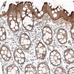 FAT1 Antibody in Immunohistochemistry (Paraffin) (IHC (P))