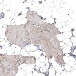 FAT1 Antibody in Immunohistochemistry (Paraffin) (IHC (P))
