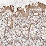 FAT1 Antibody in Immunohistochemistry (IHC)
