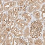 TBC1D8B Antibody in Immunohistochemistry (Paraffin) (IHC (P))