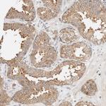 TBC1D8B Antibody in Immunohistochemistry (Paraffin) (IHC (P))