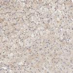 TBC1D8B Antibody in Immunohistochemistry (IHC)