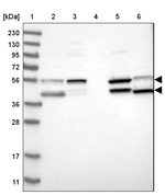 Adenosine Deaminase Antibody in Western Blot (WB)