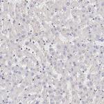 Adenosine Deaminase Antibody in Immunohistochemistry (IHC)