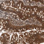 MYO1E Antibody in Immunohistochemistry (Paraffin) (IHC (P))
