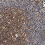 MYO1E Antibody in Immunohistochemistry (Paraffin) (IHC (P))