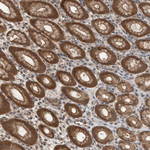 MYO1E Antibody in Immunohistochemistry (Paraffin) (IHC (P))