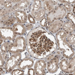 MYO1E Polyclonal Antibody