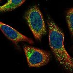 CMTM4 Polyclonal Antibody