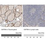 CMTM4 Antibody in Immunohistochemistry (IHC)