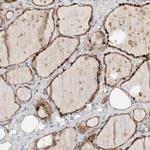 CMTM4 Antibody in Immunohistochemistry (IHC)