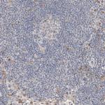CMTM4 Antibody in Immunohistochemistry (IHC)