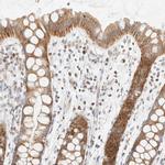 PPM1K Antibody in Immunohistochemistry (IHC)