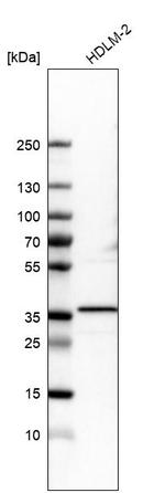 PPM1K Antibody in Western Blot (WB)