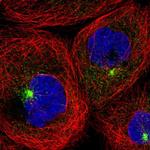 RAB11FIP1 Polyclonal Antibody