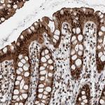 FAM135B Polyclonal Antibody