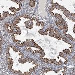 FAM78A Polyclonal Antibody