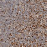 FAM167A Polyclonal Antibody