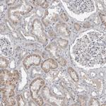 STC1 Antibody in Immunohistochemistry (IHC)