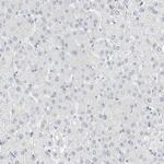 ARHGAP27 Antibody in Immunohistochemistry (Paraffin) (IHC (P))