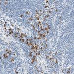 ARHGAP27 Antibody in Immunohistochemistry (Paraffin) (IHC (P))