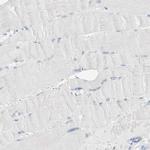 ARHGAP27 Antibody in Immunohistochemistry (Paraffin) (IHC (P))