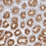 ARHGAP27 Antibody in Immunohistochemistry (Paraffin) (IHC (P))