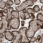 RPAIN Polyclonal Antibody