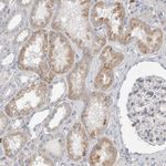 GSDMB Antibody in Immunohistochemistry (Paraffin) (IHC (P))