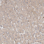GSDMB Antibody in Immunohistochemistry (Paraffin) (IHC (P))