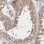 GSDMB Polyclonal Antibody