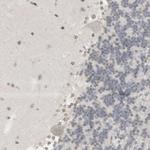 TRAM1 Antibody in Immunohistochemistry (Paraffin) (IHC (P))