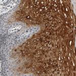 TRAM1 Polyclonal Antibody