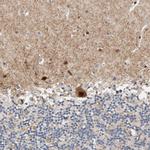 ZNF703 Antibody in Immunohistochemistry (Paraffin) (IHC (P))