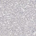 ZNF703 Antibody in Immunohistochemistry (Paraffin) (IHC (P))