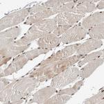 ZNF703 Antibody in Immunohistochemistry (Paraffin) (IHC (P))