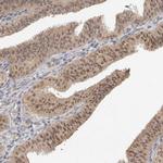 ZNF567 Antibody in Immunohistochemistry (Paraffin) (IHC (P))