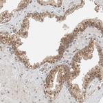 ZNF567 Antibody in Immunohistochemistry (Paraffin) (IHC (P))