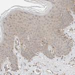 ZNF567 Antibody in Immunohistochemistry (Paraffin) (IHC (P))