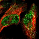 TRMT12 Polyclonal Antibody