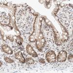 TRMT12 Antibody in Immunohistochemistry (Paraffin) (IHC (P))