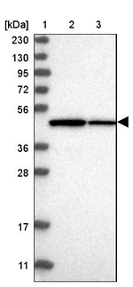 TRMT12 Antibody in Western Blot (WB)