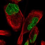 FAM135B Polyclonal Antibody